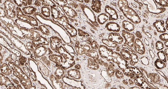 Recombinant Bad Monoclonal Antibody (AGEL5931)