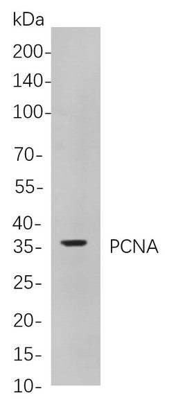 Recombinant PCNA Monoclonal Antibody (AGEL5932)