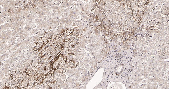Recombinant EpCAM Monoclonal Antibody (AGEL5935)