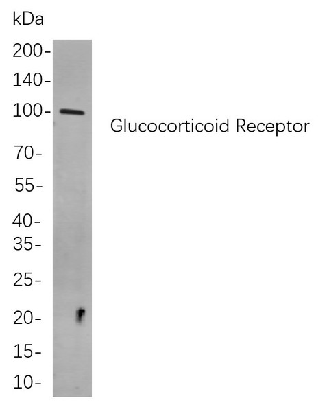 Recombinant Glucocorticoid Receptor Monoclonal Antibody (AGEL5938)