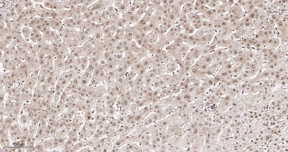 Recombinant Glucocorticoid Receptor Monoclonal Antibody (AGEL5938)