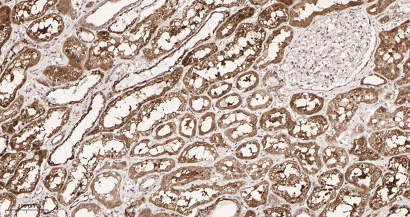 Recombinant Pyruvate Dehydrogenase E1 α Monoclonal Antibody (AGEL5943)