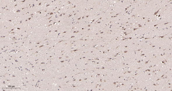 Recombinant YTHDF1 Monoclonal Antibody (AGEL5944)