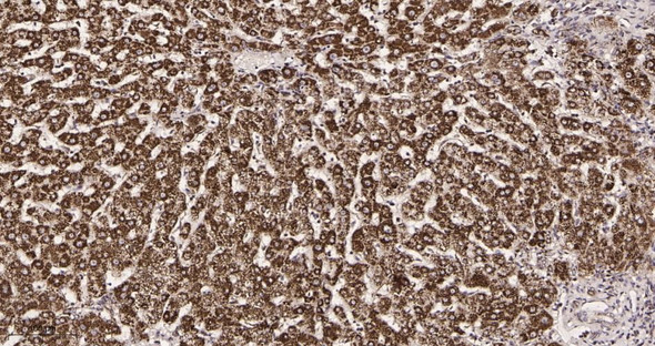 Recombinant Hsp60 Monoclonal Antibody (AGEL5945)