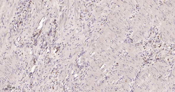 Recombinant VEGF Receptor 1 Monoclonal Antibody (AGEL5946)