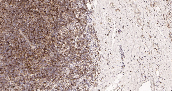 Recombinant Fas Monoclonal Antibody (AGEL5950)