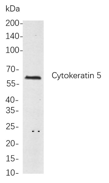 Recombinant Cytokeratin 5 Monoclonal Antibody (AGEL5952)
