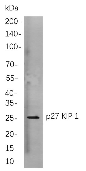 Recombinant p27 KIP 1 Monoclonal Antibody (AGEL5956)