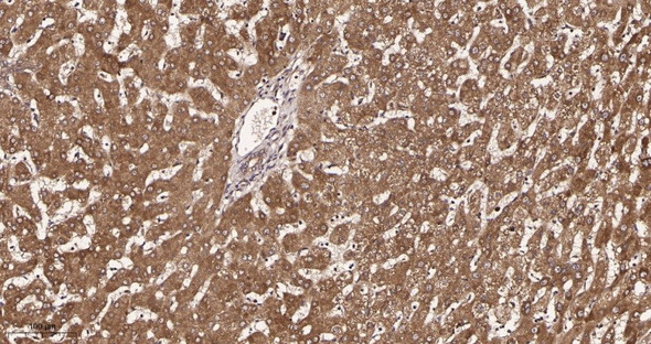 Recombinant GCLM Monoclonal Antibody (AGEL5957)