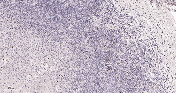 Recombinant FOXP3 Monoclonal Antibody (AGEL5958)