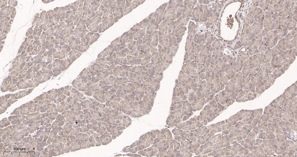 Recombinant PTEN Monoclonal Antibody (AGEL5961)