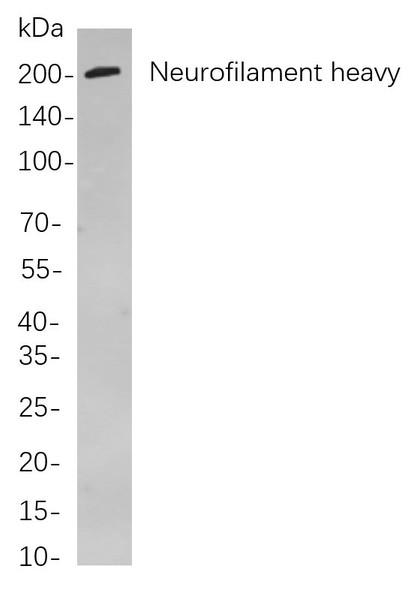 Recombinant Neurofilament heavy polypeptide Monoclonal Antibody (AGEL5964)