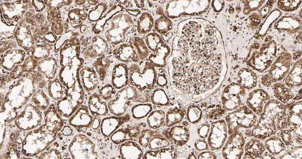 Recombinant Calreticulin Monoclonal Antibody (AGEL5965)