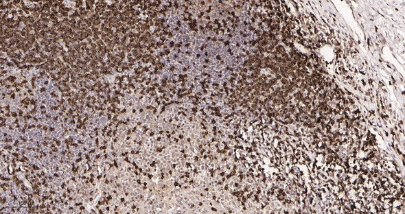 Recombinant CD3 Monoclonal Antibody (AGEL5966)