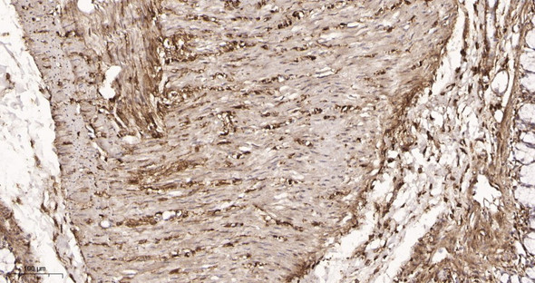 Recombinant LRP1 Monoclonal Antibody (AGEL5967)