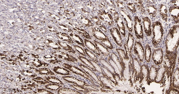 Recombinant Mucin 5AC Monoclonal Antibody (AGEL5970)