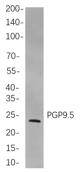 Recombinant PGP9.5 Monoclonal Antibody (AGEL5971)