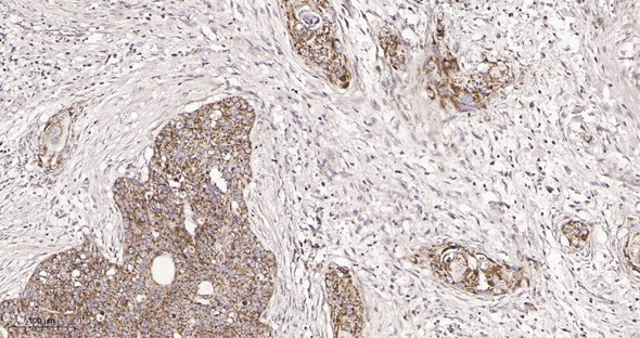 Recombinant TOMM20 Monoclonal Antibody (AGEL5973)
