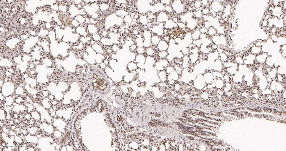 Recombinant ATF-4 Monoclonal Antibody (AGEL5974)