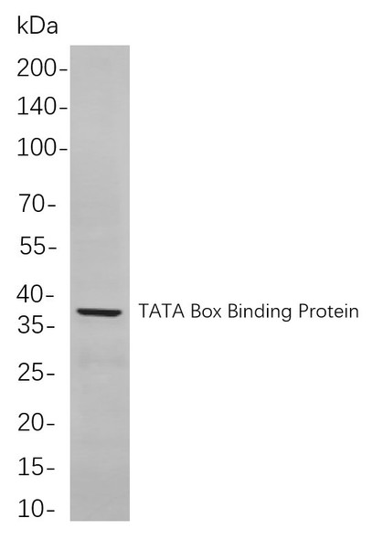 Recombinant TATA Box Binding Protein Monoclonal Antibody (AGEL5984)