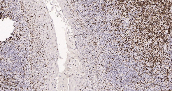 Recombinant Ctip2 Monoclonal Antibody (AGEL5985)