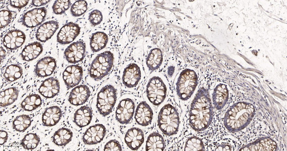 Recombinant UQCRC2 Monoclonal Antibody (AGEL5996)