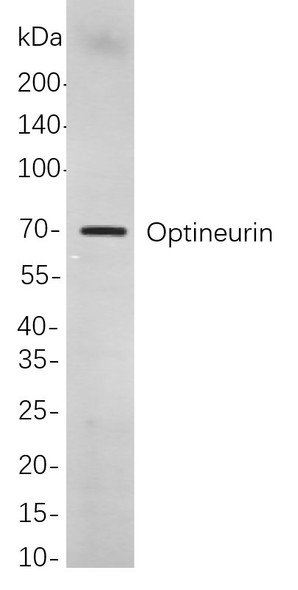 Recombinant Optineurin Monoclonal Antibody (AGEL6006)
