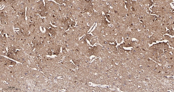 Recombinant Optineurin Monoclonal Antibody (AGEL6006)