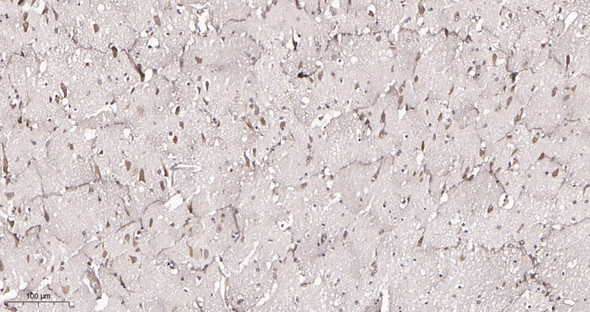 Recombinant FXR1 Monoclonal Antibody (AGEL6010)