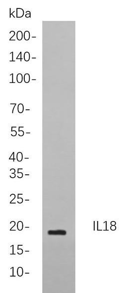 Recombinant IL18 Monoclonal Antibody (AGEL6011)