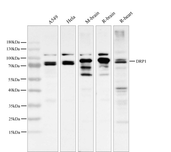 Recombinant DRP1 Monoclonal Antibody (AGEL6013)