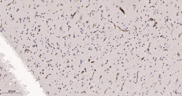 Recombinant IFITM3 Monoclonal Antibody (AGEL6015)