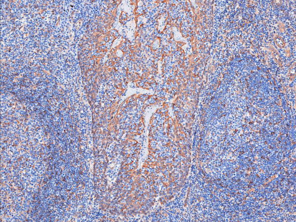 Recombinant TMEM173 Monoclonal Antibody (AGEL6017)