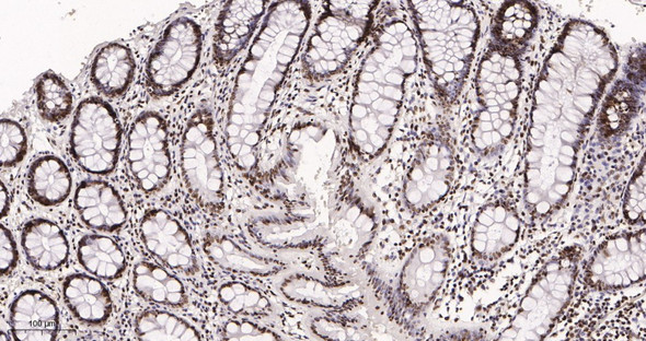 Recombinant SP1 Monoclonal Antibody (AGEL6020)
