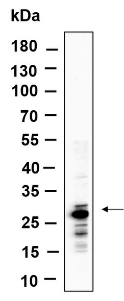 Recombinant MTCO2 Monoclonal Antibody (AGEL6035)