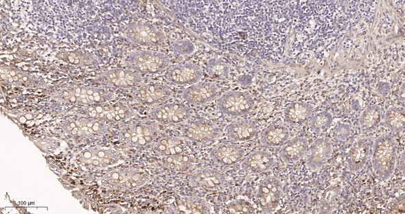 Recombinant Collagen IV Monoclonal Antibody (AGEL6038)