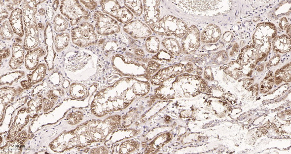 Recombinant SDHA Monoclonal Antibody (AGEL6039)