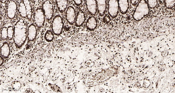 Recombinant Histone H4 Monoclonal Antibody (AGEL6041)