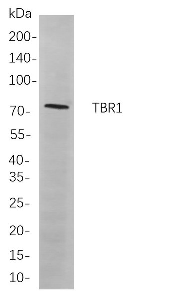 Recombinant TBR1 Monoclonal Antibody (AGEL6042)