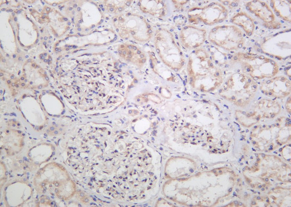 Recombinant TXD12 Monoclonal Antibody (AGEL6051)