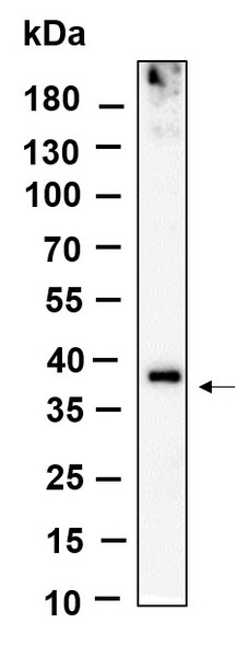 Recombinant BNI3L Monoclonal Antibody (AGEL6054)