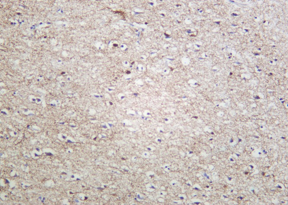 Recombinant GAD-65/67 Monoclonal Antibody (AGEL6060)