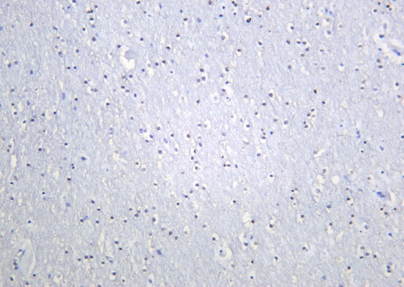 Recombinant OLIG2 Monoclonal Antibody (AGEL6061)
