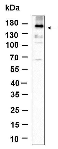 Recombinant Phospho-EGFR (Tyr1068) Monoclonal Antibody (AGEL6063)