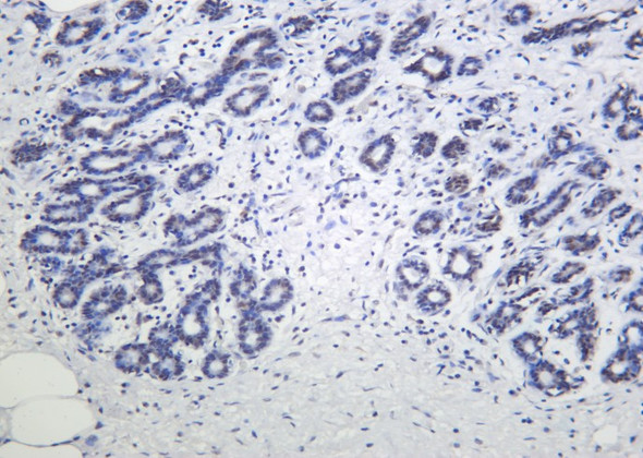 Recombinant Phospho-p53 (Ser46) Monoclonal Antibody (AGEL6071)