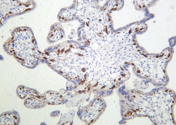 Recombinant FoxO4 Monoclonal Antibody (AGEL6073)