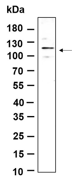 Recombinant Phospho-FAK (Tyr397) Monoclonal Antibody (AGEL6080)
