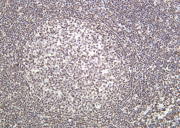 Recombinant Histone H3 (Acetyl Lys14) Monoclonal Antibody (AGEL6086)