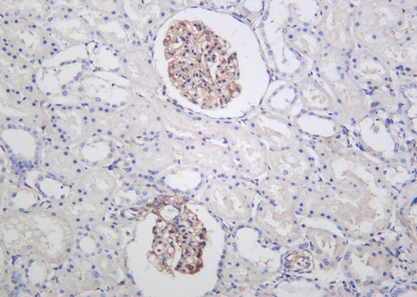 Recombinant ILK Monoclonal Antibody (AGEL6101)