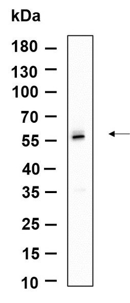 Recombinant TRAF2 Monoclonal Antibody (AGEL6102)
